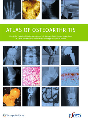 cover image of Atlas of Osteoarthritis
